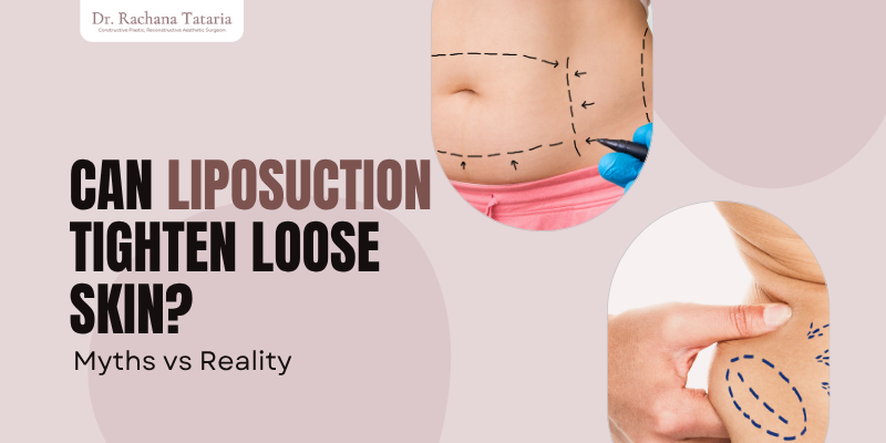 Advanced Facial Procedures