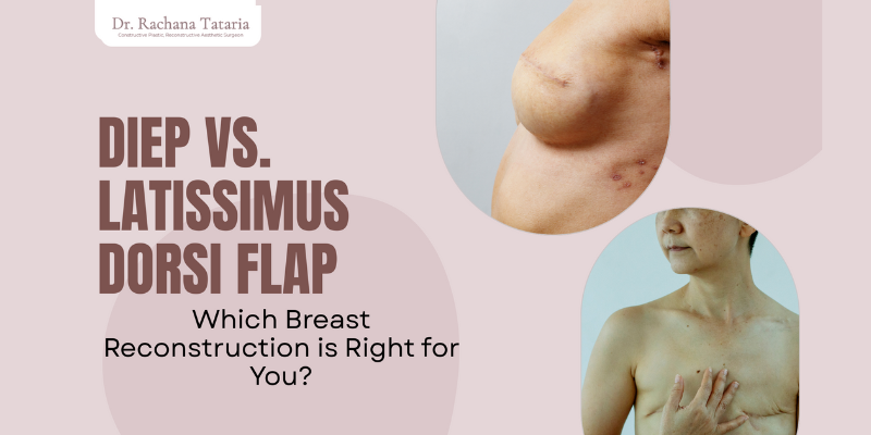 Breast Reconstruction