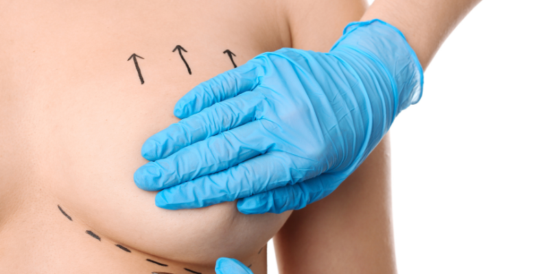 Areolar Herniation